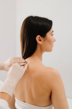 Baş ağrısı ve ağrı kesicilerin tedavisi. Doktor tarafından migren tedavisi için sırtında işaretli noktalar var. Migren tedavisi için cilt hazırlama