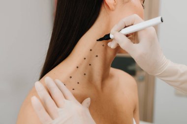 Kozmetik uzmanı bir kadının platizmasına botulinyum toksin enjekte edilmeden önce nokta çiziyor. Bir profesyonelden boyun geliştirme. Kadın estetik kozmetolojisi. Nefertiti kaldırmadan önce işaretle