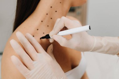 Kozmetik uzmanı bir kadının platizmasına botulinyum toksin enjekte edilmeden önce nokta çiziyor. Bir profesyonelden boyun geliştirme. Kadın estetik kozmetolojisi. Nefertiti kaldırmadan önce işaretle