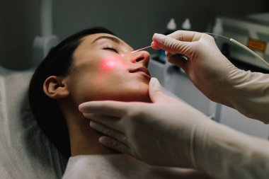 Dermatolog, yüz nevusu ve diğer iyi huylu lezyonların kesin lazerle alınmasını sağlıyor. Nevus ve ben aldırma için lazer dermatolojik tedavi. Kömür ve iyi huylu büyümelerin estetik lazerle temizlenmesi