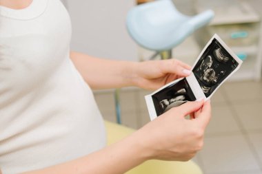 Anneliğin değerli anlarını ultrasonla kaydediyorum. Hamile bir kadın karnındaki bebek ultrasonu fotoğrafına bakar.