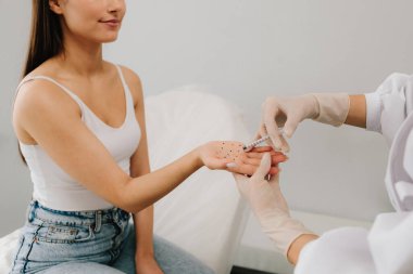 Hiperhidroz tedavisini işaretle ve enjekte et. Avuç içi terlemesi. İşaretli noktalara enjeksiyon yap. Hiperhidroza karşı bir hastanın avuç içi.