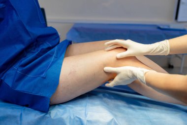 Doktor olarak vasküler bacak muayenesi, damar örneklerini değerlendirmek için uyluk kemiğini muayene eder ve paletler.