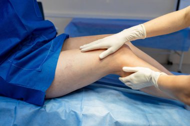 Damar Cerrahı uyluk damarlarında damar kalıpları ve dolaşımı kontrol ediyor.