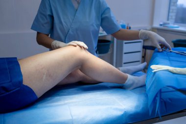 Bacak damarlarını nazikçe muayene eden profesyonel bir doktor.