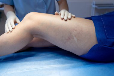 Doktor bacağındaki damarı dikkatle muayene ediyor.