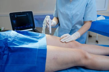 Doktor, damar uzmanının bacak damarlarını kontrol etmek için ultrason taraması yapıyor.
