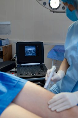 Tıbbi profesyonel bacak damar ultrasonu.