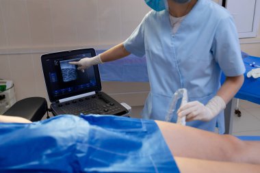 Doktor tarafından hastanın bacak damarlarının ultrason görüntüsü.