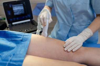 Doktor yüksek çözünürlüklü ultrason kullanarak bacak damarlarını tarıyor.