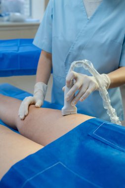 Tıbbi uzman bacak damarlarının Doppler taramasını yapıyor.