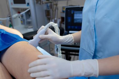 Damar cerrahı tarafından damar kontrolü için bacak ultrasonu