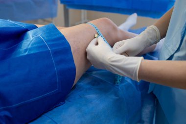 Ameliyat öncesi değerlendirmeler için bacak boyutlarını ölçen doktor.