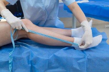 Damar cerrahı tarafından ölçülen bacak uzunluğu ve çapı