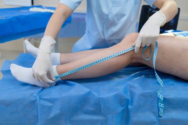 Damar muayenesi için bacak kalınlığı ve uzunluğu ölçen doktor.