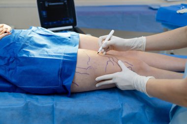 Damar cerrahı tarafından ameliyat öncesi damar haritalama