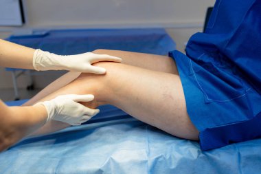 Doktor vasküler kalıpları belirlemek için bacak damarlarını muayene ediyor ve muayene ediyor.