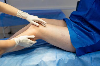 Görsel ve elle muayene yöntemleri kullanan doktor tarafından bacak damarı muayenesi