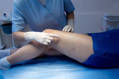 Uyluğu elle muayene ederek damar örneklerini ölçen profesyonel bir sağlık uzmanı.