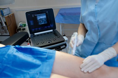 Damar uzmanı ultrason ile bacak damarlarını inceliyor.