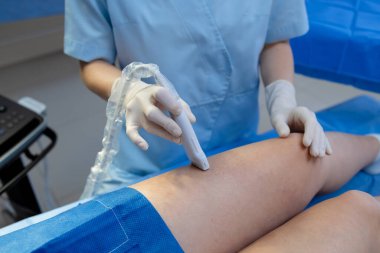Damar uzmanı ultrason ile bacak damar taraması yapıyor.