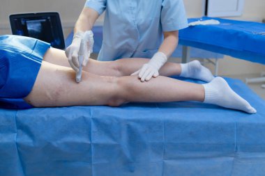 Damar uzmanı bacak damarı Doppler ultrason taraması yapıyor.