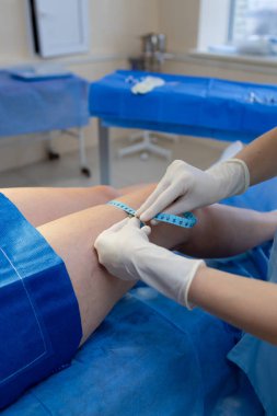 Damar uzmanı bacak boyutunu ve çevresini kontrol ediyor.