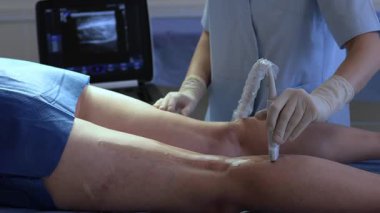Bacak damarlarının ultrason incelemesi 4K video. Damar cerrahı tarafından damar kontrolü için bacak ultrasonu.