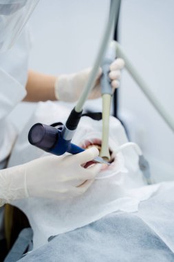 Dişleri temizlemek ve klinikteki yüzey lekelerini çıkarmak için hava akışı prosedürü