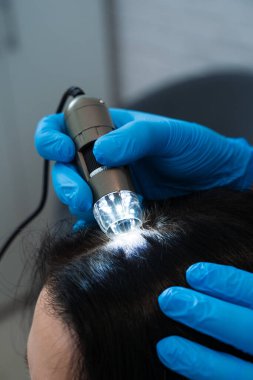 Saç folikülleri ve kafa derisi analizi için dijital trikoskopi