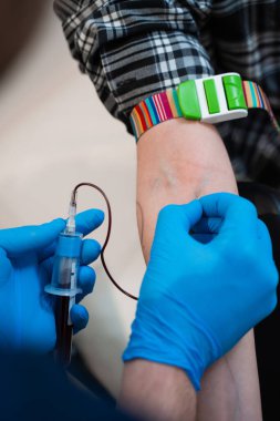 PRP hazırlığı için tıp uzmanı tarafından kafa derisi mezoterapisinden önce toplanan venöz kan.