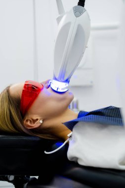 Profesyonel diş beyazlatıcı, daha parlak ve sağlıklı bir gülümseme için jel.