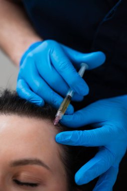 Saç kökü için trikoloğun yaptığı mikro enjeksiyonlarla kafa derisi mezoterapisi.