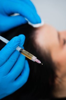 Saç kökü, trikoloğun kafa derisi mezoterapi mikro enjeksiyonlarıyla besleniyor.