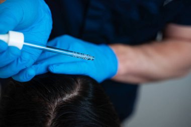 Saç terapisi seansından sonra aktif serumla kafa derisi tedavisi