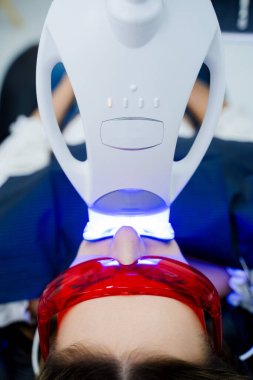 Dişlerinin beyazlatılması dişçi tarafından sağlıklı bir gülümseme için uygulanır.