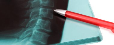 Roentgenbild Wirbelsaeule mit rotem Kugelschreiber Banner