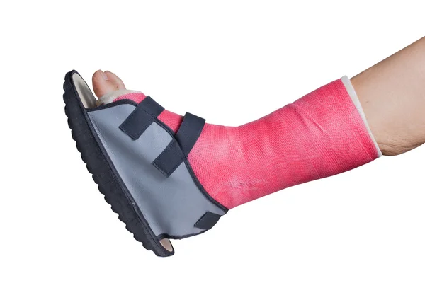 Foot splint treatment — Stock Photo, Image