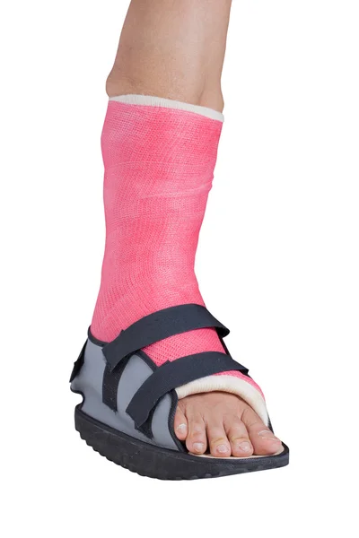 Foot splint treatment — Stock Photo, Image