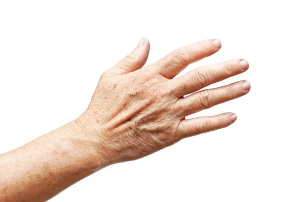 Old female hand full of freckles — Stock Photo, Image