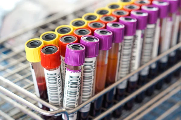 Blood sample tubes — Stock Photo, Image