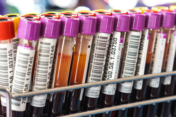 blood sample tubes