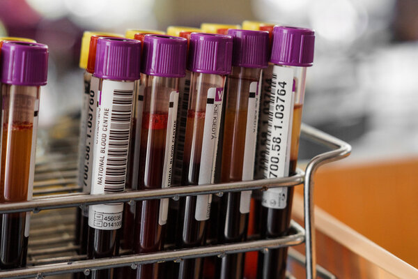 blood sample tubes