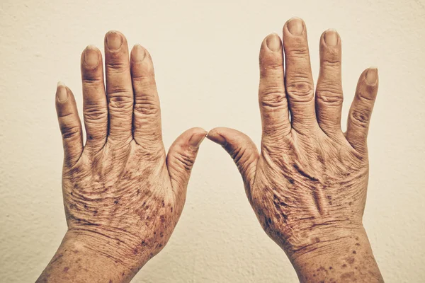 Velhas mãos femininas — Fotografia de Stock