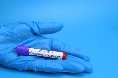 Doktor, hemşire koronavirüs için pozitif kan testi yapın.