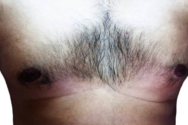 Adamın göğsü ve midesi kıllı.