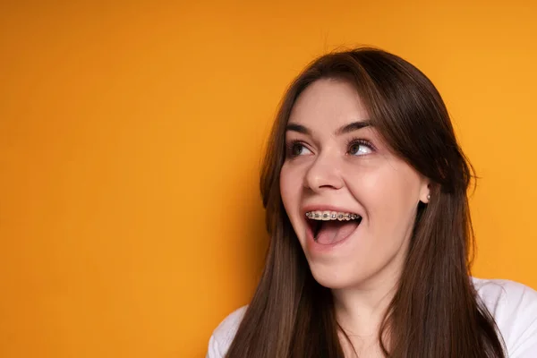 Jovem feliz ri com a boca bem aberta regozijando-se com a instalação de aparelho e olha para o lado — Fotografia de Stock