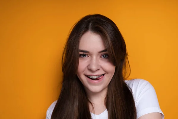 Chica alegre con frenos sonrisas abriendo la boca y mordiéndose la lengua y mirando a la cámara —  Fotos de Stock