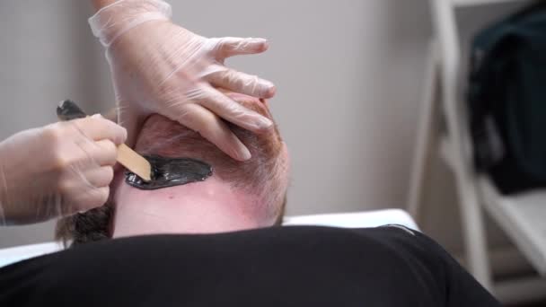 Master Doctor Performs Procedure Removing Unwanted Facial Hair Bearded Man — Vídeo de Stock