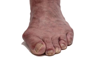 Mavi damarları olan yaşlı bir adamın bacakları. İzole edilmiş beyaz bir arkaplanda.